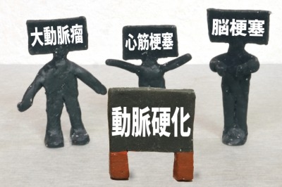 特に漢方食養療法が効果がある疾患　動脈硬化の画像